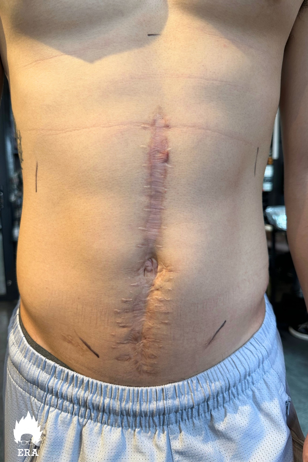 362635669 658381559669780 1216978053081841477 n